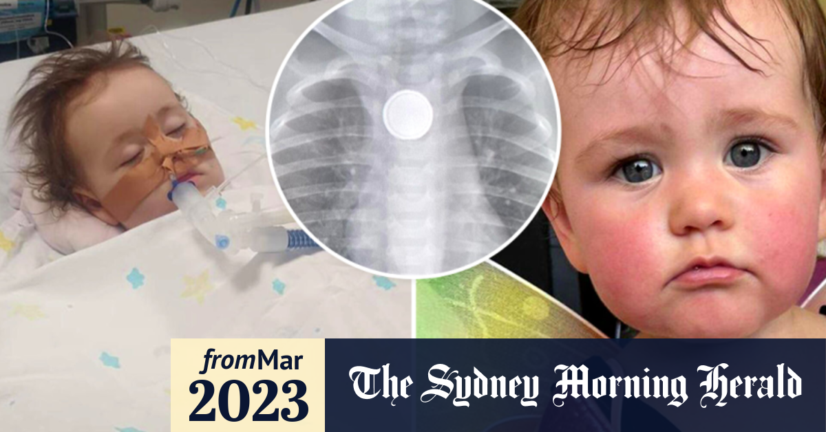 Video Qld baby who swallowed button battery breathes unassisted